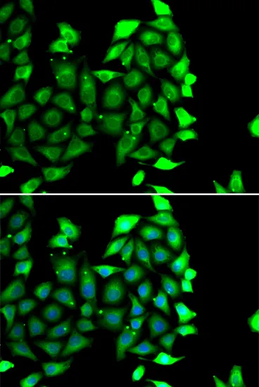 IKZF3 Polyclonal Antibody - image 1