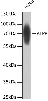 ALPP Polyclonal Antibody - image 1