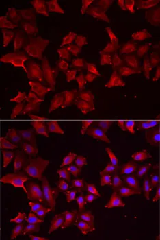 PCBD1 Polyclonal Antibody - image 1