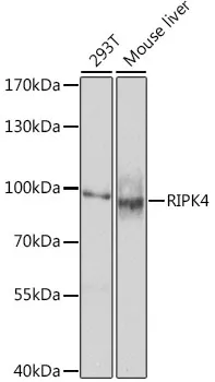 RIPK4 Polyclonal Antibody - image 1