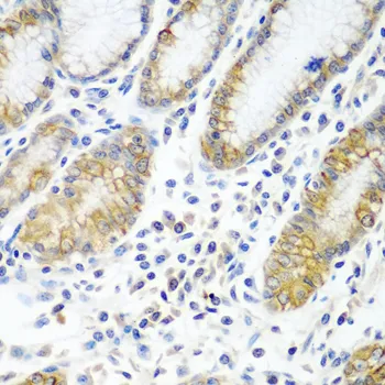 ATAD3A Polyclonal Antibody - image 1