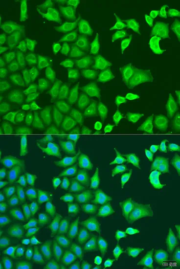 CAPZB Polyclonal Antibody - image 1