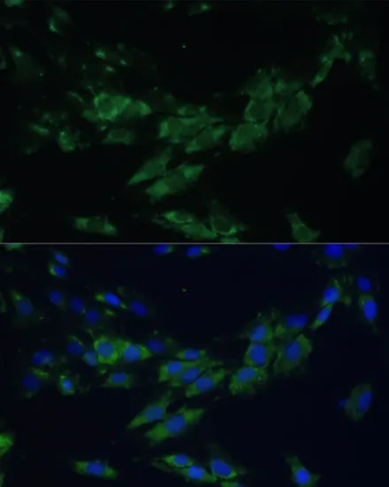 EPHA4 Polyclonal Antibody - image 1