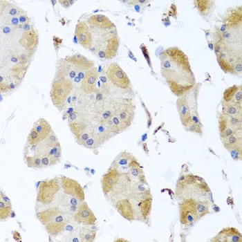 MYLK Polyclonal Antibody - image 1