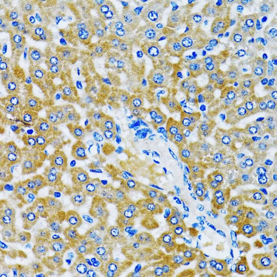 HDAC5 Polyclonal Antibody - image 1