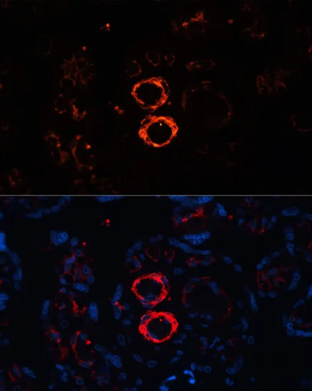 MYH11 Polyclonal Antibody - image 1