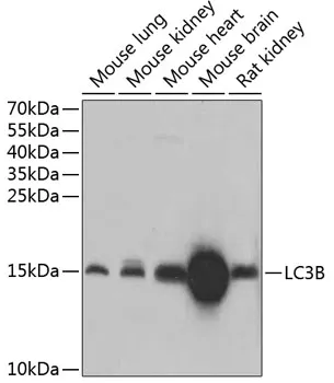 (KO Validated) LC3B Polyclonal Antibody - image 1