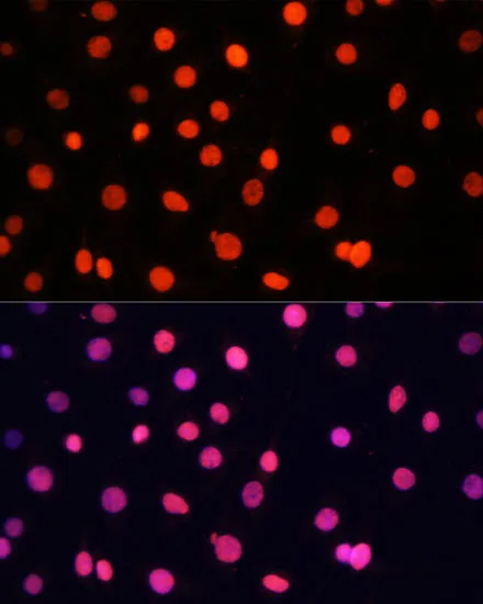 SOX2 Polyclonal Antibody - image 1