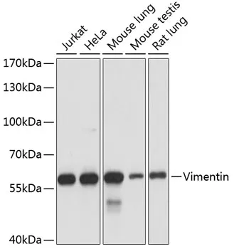 (KO Validated) Vimentin Polyclonal Antibody - image 1