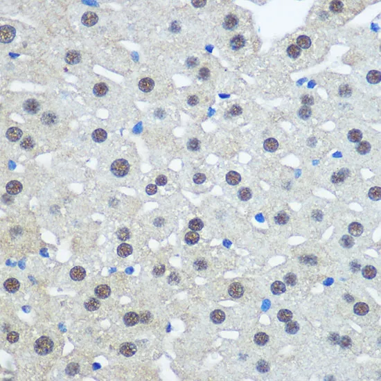 UBA1 Polyclonal Antibody - image 1