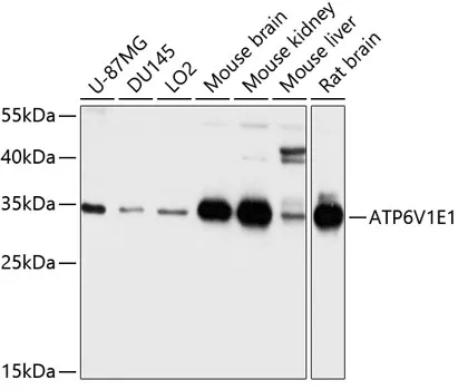 ATP6V1E1 Polyclonal Antibody - image 1