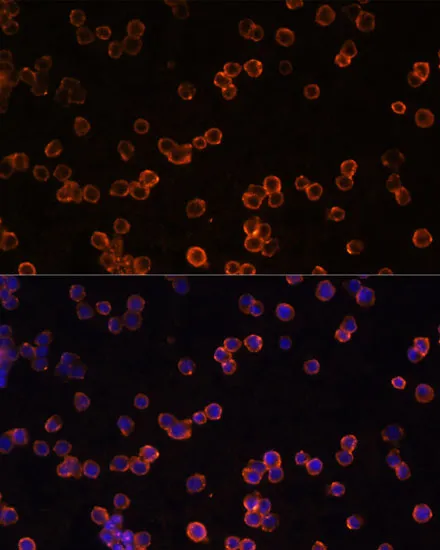 ENTPD1/CD39 Polyclonal Antibody - image 1