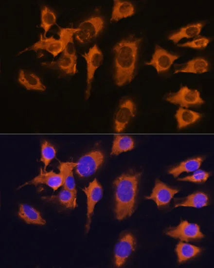 SLC20A1 Polyclonal Antibody - image 1