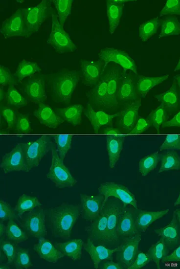 (KO Validated) PRMT6 Polyclonal Antibody - image 1