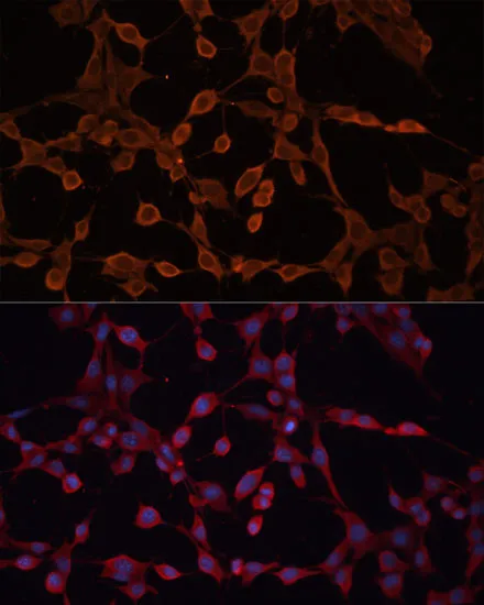 ABCB11 Polyclonal Antibody - image 1