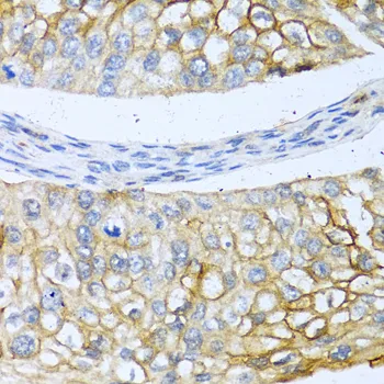 BMP4 Polyclonal Antibody - image 1