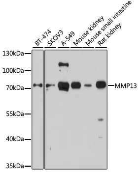 (KO Validated) MMP13 Polyclonal Antibody - image 1