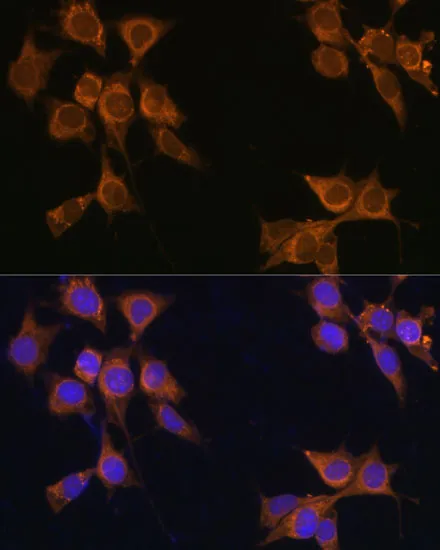(KO Validated) CD133 Polyclonal Antibody - image 1