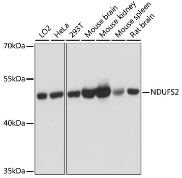 (KO Validated) NDUFS2 Polyclonal Antibody - image 1