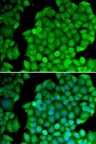 Cyclin D2 Polyclonal Antibody - image 1