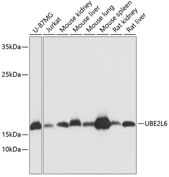 UBE2L6 Polyclonal Antibody - image 1