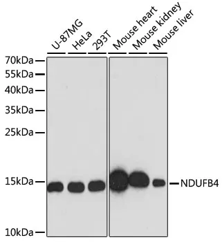 (KO Validated) NDUFB4 Polyclonal Antibody - image 1