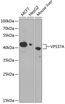 VPS37A Polyclonal Antibody - image 1