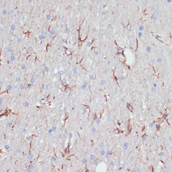 GFAP Polyclonal Antibody - image 1