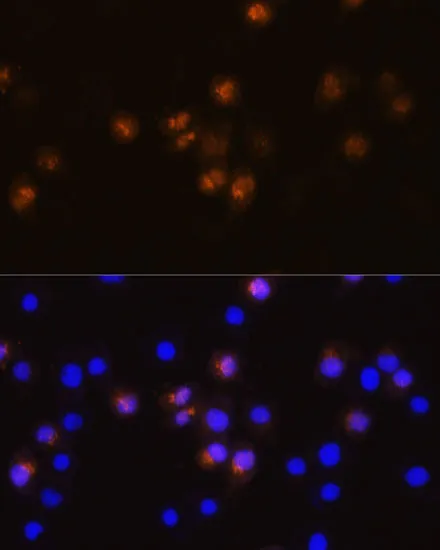 SWAP70 Polyclonal Antibody - image 1