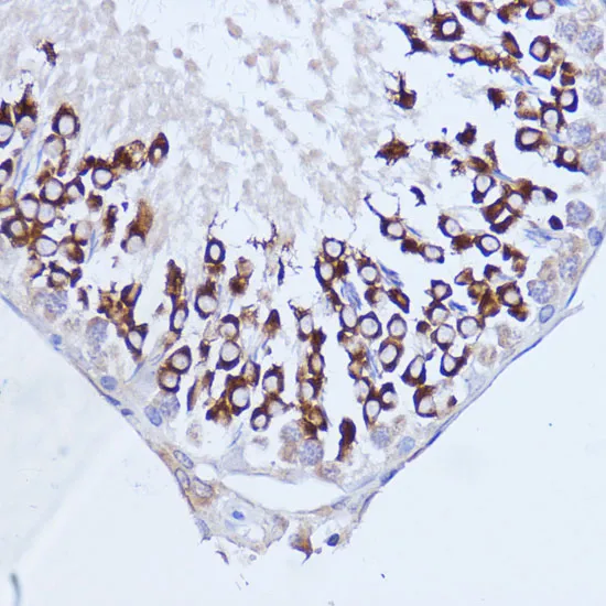 Polyclonal AntibodyPC1 Polyclonal Antibody - image 1