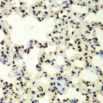 SUMO2 Polyclonal Antibody - image 1
