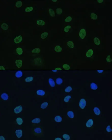 GTF2E1 Polyclonal Antibody - image 1