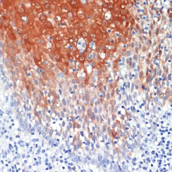S100A8 Polyclonal Antibody - image 1