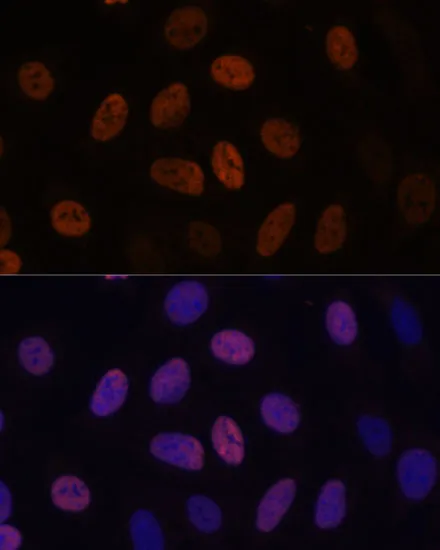 WDHD1 Polyclonal Antibody - image 1