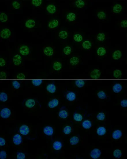GTF2B Polyclonal Antibody - image 1