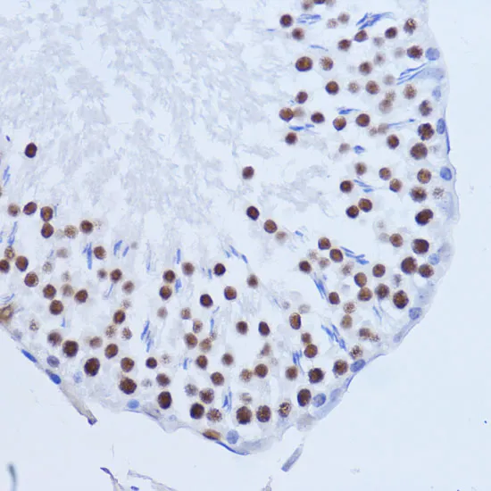 MATR3 Polyclonal Antibody - image 1