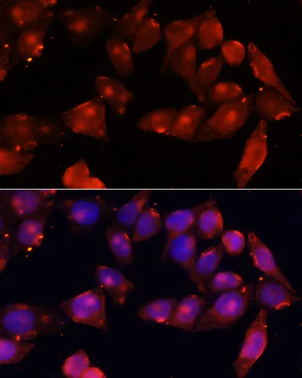 ACVR2B Polyclonal Antibody - image 1