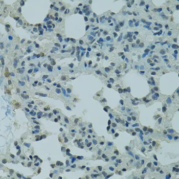 PRDM2 Polyclonal Antibody - image 1