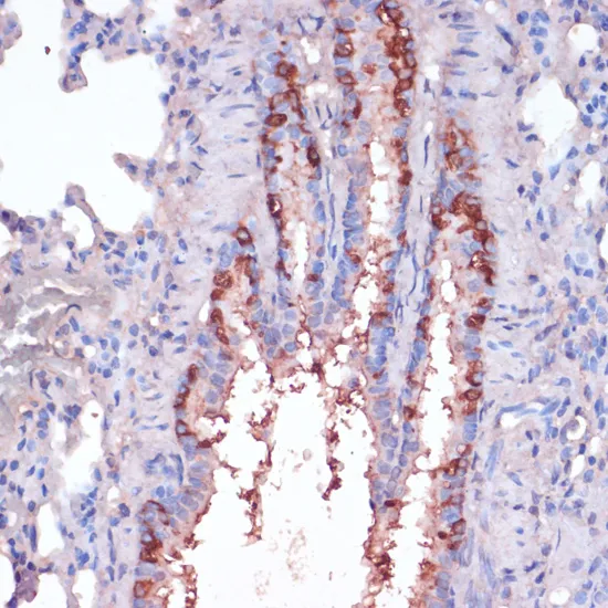 (KO Validated) RPL22 Polyclonal Antibody - image 1