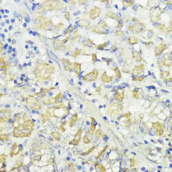 CTSB Polyclonal Antibody - image 1