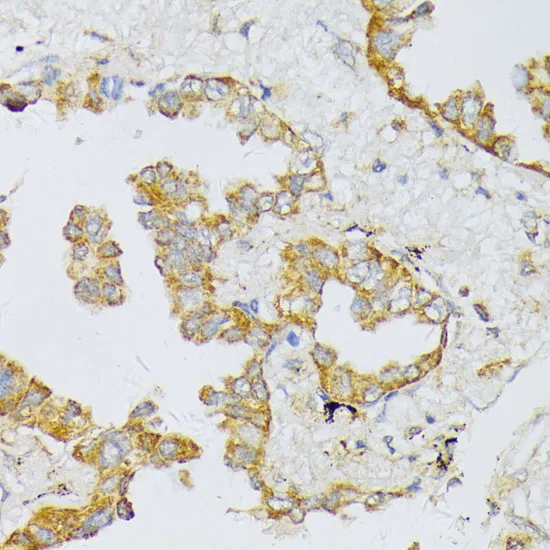 ART1 Polyclonal Antibody - image 1