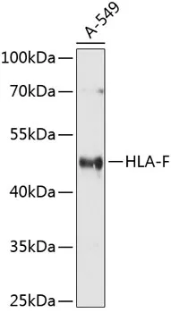 HLA-F Polyclonal Antibody - image 1