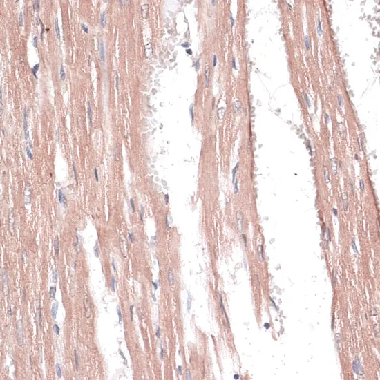 COL11A1 Polyclonal Antibody - image 1