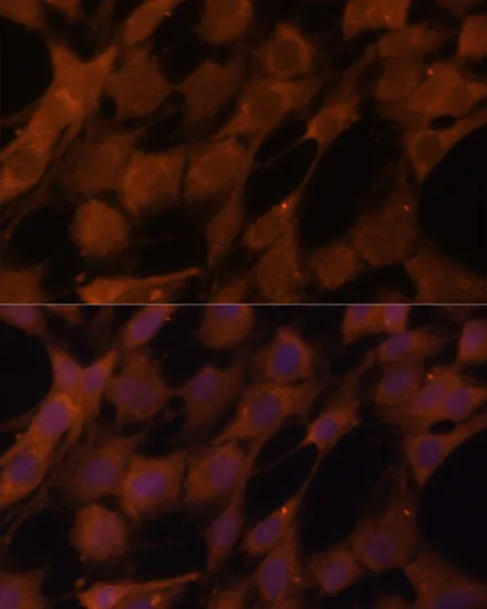 LGMN Polyclonal Antibody - image 1