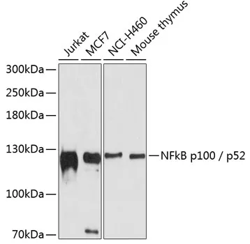 NFkB p100 / p52 Polyclonal Antibody - image 1