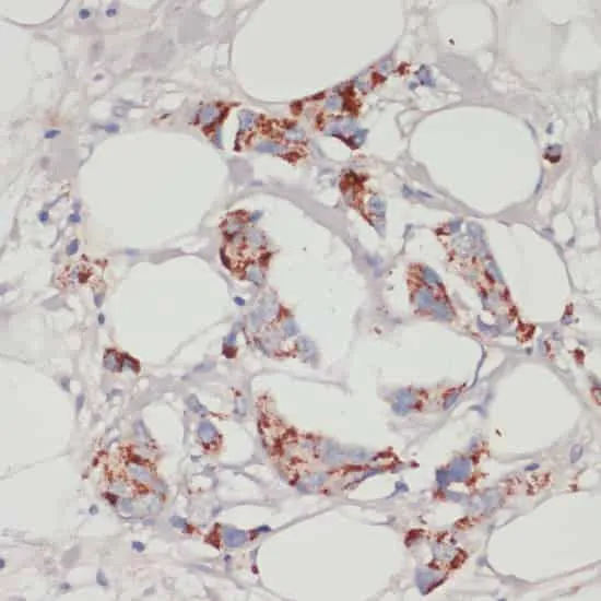 ACSL3 Polyclonal Antibody - image 1
