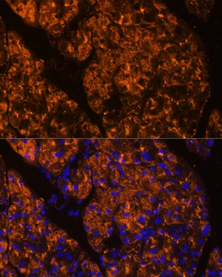 SERPINI2 Polyclonal Antibody - image 1