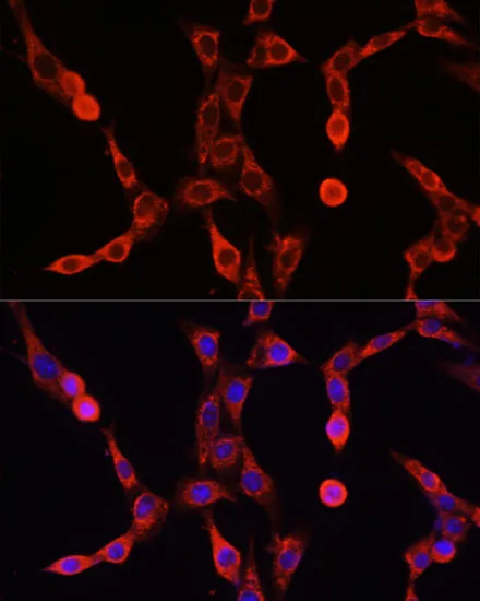 ABCD1 Polyclonal Antibody - image 1