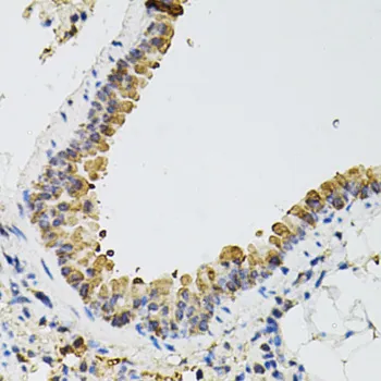 ARHGEF2 Polyclonal Antibody - image 1