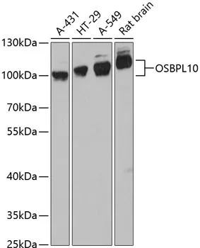 OSBPL10 Polyclonal Antibody - image 1